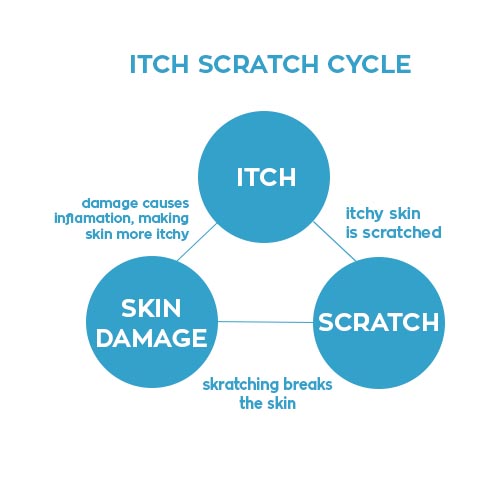 ITCH-SRATCH CYCLE