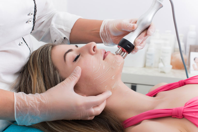 laser treatment for acne scars
