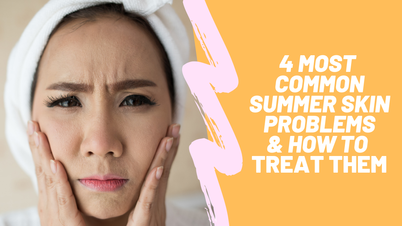 Top 4 Summer Skin Problems & How to Treat Them
