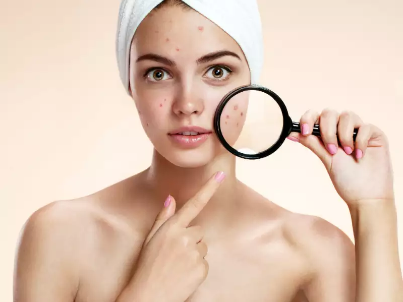 Wondering how to get rid of dark spots on the face? We've got you covered!.