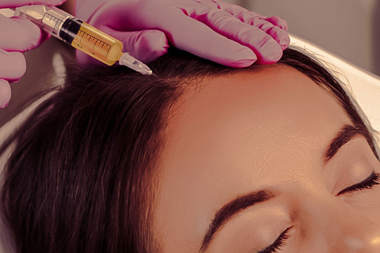 PRP hair treatment gurgaon